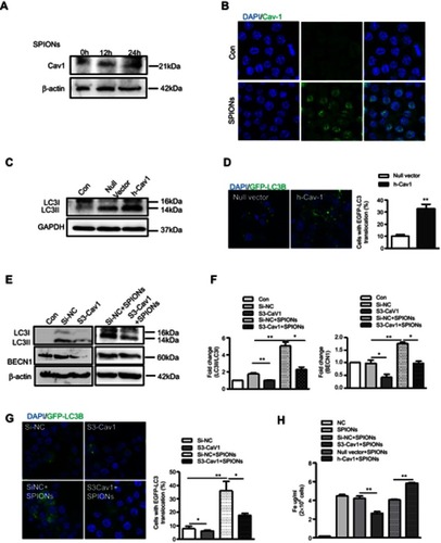 Figure 6 Cav1 mediates SPIONs-induced autophagy in macrophages. (A) Immunoblotting analysis showing expression of Cav1 in RAW 264.7 cells not stimulated or stimulated with 200 µg/mL SPIONs for 24 h. Density of Cav1 bands was quantified and normalized to β-actin. (B) Immunoﬂuorescent analysis of Cav1 (green) and nuclear DAPI (blue) followed by processing for confocal microscopy. (C) The protein expression levels of LC3II were detected by Western blot in RAW 264.7 cells transfected with Cav1 plasmids for 24 h. Density of Cav1 bands was quantified and normalized to GAPDH. (D) Confocal immunofluorescent staining of GFP-LC3 (green) and nuclear DAPI staining (blue) in RAW264.7 cells transfected with GFP-LC3 plasmids and treated with Cav1 plasmid for 24 h. Number of LC3 puncta per cell was quantified by confocal microscopy. (E, F) Immunoblotting analysis of LC3I, LC3II and BECN1 in RAW 264.7 cells transfected with Si-Cav1 for 24 h and then stimulated with SPIONs for 24 h. LC3II:LC3I ratio and BECN-1 were normalized to β-actin (G) Fluorescent images of RAW 264.7 cells transfected with GFP-LC3 plasmids followed by treatment with Si-Cav1 for 24 h and subsequent stimulation with SPIONs for 24 h. LC3-II puncta (green) were observed by confocal microscopy. (H) Total Fe was quantified using an atomic absorption spectroscopy graphite furnace in RAW 264.7 cells transfected with Cav1 plasmid or Si-Cav1 followed by stimulation with SPIONs for 24 h. Data with error bars are presented as the mean ± SD. Each panel is a representative experiment of at least three independent biological replicates. *p<0.05 and **p<0.01as determined by unpaired Student’s t-test.Abbreviations: SPIONS, superparamagnetic iron oxide nanoparticles; LPS, lipopolysaccharide; Baf-A1, Bafilomycin A1; LC3B, light chain 3B; BECN1, Beclin 1; Cav1, Caveolin-1; DAPI, 4ʹ, 6-diamidino-2-phenylindole; BMDMs, bone marrow derived macrophage cells.