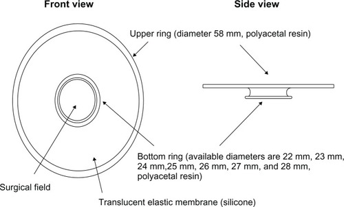 Figure 1 The diagram of a novel lid speculum with a drape (LiDrape®).