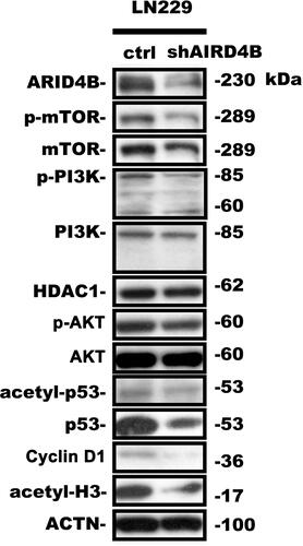 Figure 8 Effect of ARID4B knockdown on expression of the indicated proteins. Western blot analysis of expression of the indicated proteins in LN229 cells. Statistical data are presented as the mean ± s.d.; n = 3; in Table 1.