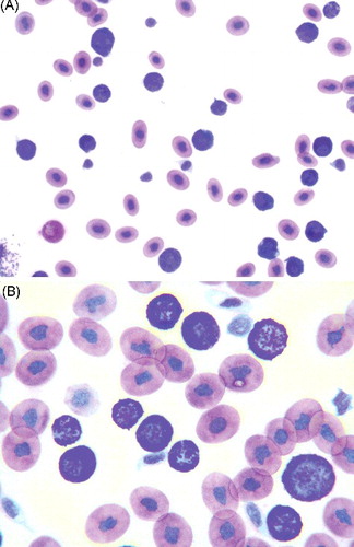 Figure 1. (A,B) Blood smear from a hognose snake showing a predominance of granulocytes with frequent metachromatic granules exhibiting a high and variable nuclear to cytoplasm ratio strongly suggestive of basophils (Wright–Giemsa stain, A: ×10 objective; B: ×50 objective).