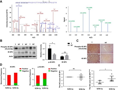 Figure 5 Validation of the differentially expressed phosphoproteins and phosphorylation site. (A) The relative intensity of reporter ion of the 8-plex iTRAQ reagent regarding 4E-BP1Thr46 in MS/MS spectra. (B) The level of 4E-BP1Thr37/Thr46 validated by Western-Blot are up-regulated in the HCC tissues comparing with surrounding non-cancerous tissues. (C) The level of 4E-BP1Thr37/Thr46 validated by IHC is up-regulated in the HCC tissues comparing with surrounding non-cancerous tissues. (D) The recurrence frequency of 4E-BP1Thr37/Thr46 was more positive in patients with early recurrence (recurrence within 1 year) than patients with late recurrence (recurrence after 3 years). (E) The IHC score of 4E-BP1Thr37/Thr46 was higher in patients with late recurrence (recurrence after 3 years) than patients with early recurrence (recurrence within 1 year). *p < 0.05.