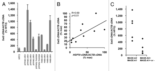 Figure 4.Sat2 RNA levels are correlated with HSP70 expression in melanoma tissues. (A) Relative Sat2 RNA levels measured in 6 primary melanoma tumors and 4 melanoma metastases. Data are presented as % ± SEM of the expression measured in HFF2. (B) Comparison between Sat2 and HSP70 expression levels in melanoma tissues from A. Both Sat2 and HSP70 cDNA levels were normalized to ACTB cDNA and expressed as % of the maximal value measured in the samples. (C) Melanoma tissues from A were classified into two groups according to the presence (+) or the absence (-) of MAGE-A2 or MAGE-A1 transcripts. Relative Sat2 RNA levels, as described in A, are indicated.