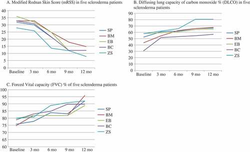 Figure 1. Changes in (A) the modified Rodnan skin score (mRSS), (B) the diffusing capacity of the lung for carbon monoxide (DLCO), and (C) forced vital capacity (FVC) measurements in all five scleroderma patients (SP, BM, EB, BC, and ZS) treated with rituximab at 0, 3, 6, and 12 months. Changes in mRSS and DLCO are shown as percentages for up to 12 months of treatment with rituximab. There was a significant decrease (mean ± SD) in mRSS in all five patients (26.5 ± 8.3% vs. 11.8 ± 2.9%, p < 0.001). DLCO improved after the therapy with rituximab in all patients (48.5 ± 6.7% vs. 66.0 ± 4.0%, p < 0.001). FVC improved significantly after 6 months (72 ± 5.2% vs. 82 ± 5.9%, p < 0.008) and 12 months (72 ± 5.2% vs. 89 ± 3.2%, p < 0.004).