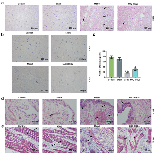 Figure 3. Transplantation of hUC-MSCs partially restored the motor function of spinal cord injury (SCI) rats by ameliorating the destructive lesions. (a–e) Transplantation of hUC-MSCs ameliorated spinal cord and bladder lesions induced by SCI. Hematoxylin–eosin (HE) staining of the dorsal side of the spinal cord (scale: 200 μm; magnification: 100×) (a). Luxol fast blue (LFB) was applied to assess the survival rate of neuronal cells in the spinal cord injury area (scale: 200 μm, magnification: 100 ×) (b-c). HE staining of bladder tissues (scale: 200 μm; magnification: 100×) (d). Masson’s trichrome staining of bladder tissues (scale: 200 μm; magnification: 100×) (e). *** P < 0.001 vs. Sham, # P < 0.05 vs. Model.