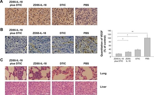 Figure 5 ZD55-IL-18 and DTIC demonstrated synergistic effects to induce apoptosis and upregulate VEGF expression in melanoma mouse xenografts.