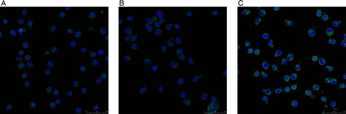 Figure 7. Expression of ICAM-1 in KM3 cells was analyzed by laser confocal fluorescence microscopy. (A) The KM3 group. (B) The KM3/hUCBDSC co-culture group. (C) The KM3/MM-BMSC co-culture group. After sub-culture for 4 days, KM3 cells from each of the three groups were collected, and the expression levels of ICAM-1 were examined by laser confocal fluorescence microscopy. The MFI of ICAM-1 in KM3 cells from the KM3/hUCBDSC group was lower than in the KM3/MM-BMSC group. Each experiment was performed three times. hUCBDSCs, human umbilical cord blood-derived stromal cells; MM-BMSCs, multiple myeloma bone marrow stromal cells; ICAM-1, intercellular adhesion molecule-1; MFI, mean fluorescence intensity.