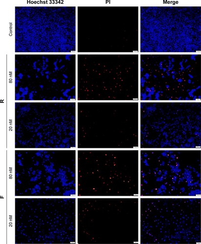 Figure 6 Representative photomicrographs (Olympus, Tokyo, Japan; magnification, ×100) of MGC-803 cells stained with Hoechst 33342 and PI fluorescent dye after the exposure of the cells to the purified peptides at different concentrations.