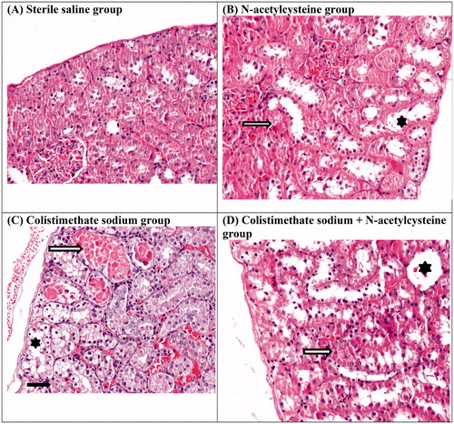 Figure 2. Histological findings of the study: normal kidney structure of the sterile saline group (A), Grade 1 renal histological lesion in N-acetylcysteine group (B), Grade 2 renal histological lesion in colistimethate sodium group (C), Grade 1 renal histological lesion in colistimethate sodium + N-acetylcysteine group (D). Tubular dilatation (asterisk), tubular casts (hollow arrow), and tubular cell necrosis (black arrow) (original magnification ×200).