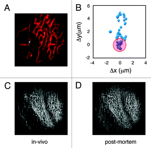 Figure 4. (A) A reconstructed stabilized image of the cardiac microvasculature stained with lectin (red). FITC-labeled beads (5 µm diameter; green) were injected into the live mouse prior to imaging. Beads trapped within the vasculature were subsequently used as fiducial markers to quantify tissue displacement caused by motion. Images were acquired with a 6x MicroProbe objective (Olympus, IV-OB13F67W20). (B) The position of a single bead (blue diamonds) was determined across several frames following application of the stabilizer. When the bead’s position was determined within the temporal stabilized window (W3), the amount of displacement was greatly reduced (variations in the bead’s position are indicated by the red circle). A comparison between in vivo reconstructions (C) and post-mortem imaging (D) demonstrates the effectiveness of the proposed method.