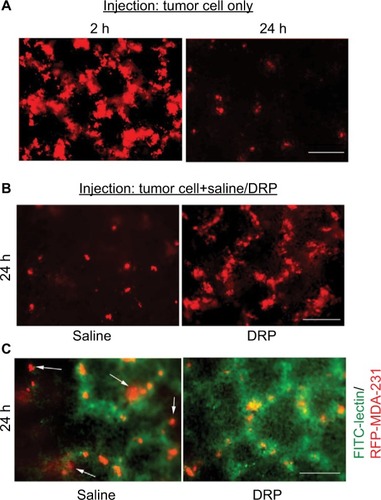 Figure 2 Effect of DRP on lung extravasation of MDA-231 cells.