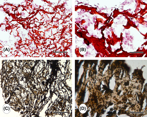 Figure 4. Representative light micrographs of cell-laden CS/HA scaffold. (A) Homogenous distribution of cells inside the construct pores after 7 days of culture is visible (B is the magnified image of A) (H&E-staining). (C) Mineral deposits and ECM have predominantly covered the scaffold after 21 days of culture (D is the magnified image of C) (von Kossa-staining). Scale bars: 300 μm (A, C), 150 μm (B, D).