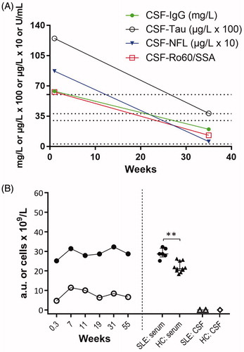 Figure 4. (A and B) Laboratory of data: (A) CSF markers of damage and immune activation; IgG (ref. <38 mg/L), Tau (ref. <300 ng/L) and NFL (ref. <380 ng/L). (B) Left panel; serum NET remnants (filled circles) and neutrophil count (open circles) in serial blood samples from the patient. Weeks indicate time since SLE onset. Right panel; comparisons of NET remnants of the patient and healthy controls in sera and CSF, respectively. **p = .0011.