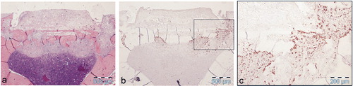 Figure 9. Specimen after 5 days of impact loading with different stainings. a) The soft tissue and the bone plate under the piston seen at 4× magnification (H&E), b) osteoclast activation concentrated under and beside the former piston seen at 4× magnification (immunohistochemistry for CatK), and c) activated osteoclasts within the bone plate seen at 10× magnification (CatK).