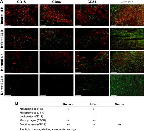 Figure 5 (A) Ex vivo CLSM images of the infarcted myocardium and normal myocardium at 4 and 24 hours post intravenous injection of MnO-PEG-Cy5.5 nanoparticles. (B) Scoring of blood vessels, leukocytes, macrophages and nanoparticles accumulation in the infarcted and remote area of rat MI heart and in the normal myocardium.Notes: Red: MnO-PEG-Cy5.5 nanoparticles; Green: CD18 (first column), CD68 (second column), CD31 (third column), or laminin (fourth column). Scale bar=100 µm.Abbreviations: CLSM, confocal laser scanning microscopy; MI, myocardial infarction.