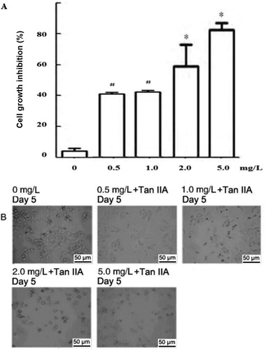 Figure 1. Effect of different concentrations of Tan IIA on proliferation and morphology of C4-1 cells. Cell growth inhibition (A) and morphology (B) of C4-1 cells.Note: C4-1 cells were grown in DMEM with or without the indicated concentrations of Tan IIA for 5 days and were plated in 96-well plates. (A) Cell proliferation inhibition rate (CPIR) was calculated on day 5 based on MTT assay results. Data are expressed as mean values from three independent experiments. #P < 0.05, *P < 0.01 vs. the control, determined by ANOVA and post hoc Bonferroni multiple comparisons test. (B) Morphology of C4-1 cells with or without Tan IIA on day 5 was observed using inverted microscopy (magnification 50×).