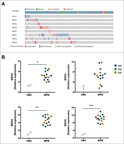 Figure 1. BRD expression in MPM. (A) Oncoprint map of BRD gene amplification, up- and down-regulation in MPM samples analyzed by the TCGA-MESO database (n = 87). Data were obtained through the cBioPortal (http://www.cbioportal.org). (B) mRNA expression of BRD2, BRD3, BRD4 and BRD9 was detected in triplicates by real-time PCR in HMC and MPM cells. *p < 0.05: mean±SEM expression for BRD2 in epithelioid (epi), biphasic (bip) and sarcomatoid (sar) MPM samples vs mean±SEM expression in HMC (3.19±0.84 vs 1.29±0.08); not significant for BRD3 (6.52±2.92 vs 1.93±0.65); **p < 0.01 for BRD4 (4.56±1.06 vs 1.26±0.38); ***p < 0.001 for BRD9 (10.19±1.87 vs 1.83±0.39).