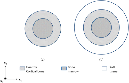 Figure 1. Illustration of (a) model 1 – Cortical bone (inner radius 7 mm and thickness 3 mm) filled with marrow and (b) model 3 – Cortical bone additionally surrounded by tissue (thickness 5 mm).