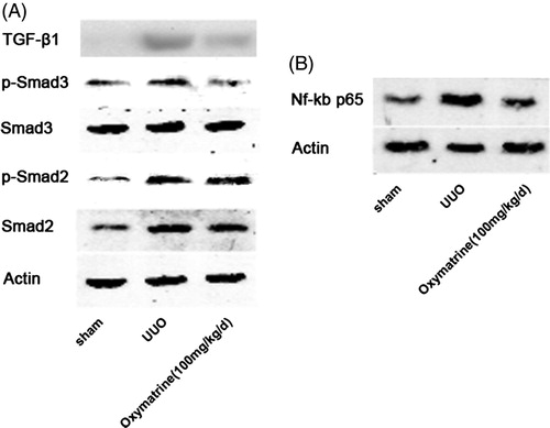 Figure 4. OMT suppresses activation of the TGF-β1/Smad3 and NF-κB signal pathways after UUO. (A) Western blot analysis for protein expression of TGF-β1, pSmad3, Smad3, pSmad2, and Smad2 in obstructed kidneys. (B) Protein expression of NF-κB p65 in kidneys was analyzed by Western blot.