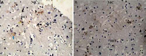 Figure 8. Photomicrograph of Corvus cornix hippocampus immunoreactivity stain showing the expressional pattern of ryanodine receptor (a, b) is the lateral hippocampus (HCl). Bar: A-B = 100 µm