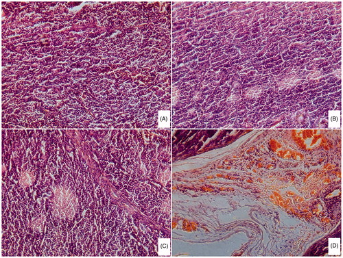 Figure 6. Photomicrograph of tumors in different groups after mice sacrifaced (H&E stain). Magnification, 200×. (A) Normal saline group; (B) free DOX group; (C) DOX/P(HB-HO) NPs group and (D) DOX/FA-PEG-P(HB-HO) NPs group.