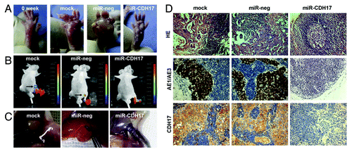 Figure 4. Knockdown of CDH17 expression inhibited lymph node metastasis in vivo. (A) The morphological characteristics of claw pads in each group were similar at the beginning, and then tumor nodules of the controls grew much larger than those of the miR-CDH17 group. (B) Two mice in both mock group and miR-neg group developed metastasis in the inguinal region, as shown by the presence of GFP-positive tumor cells. However, there was no fluorescent lesion detected in the mice of miR-CDH17 group, which was confirmed by (C) the anatomical gross specimens. (D) HE and immunohistochemisty of AE1/AE3 staining showed that the enlarged lymph nodes in mock and miR-neg group were occupied by tumor cells, as opposed to the normal lymph node in miR-CDH17 group. Additionally, CDH17 in lymphatic lesions expressed as high as it in primary ones (100 μm).