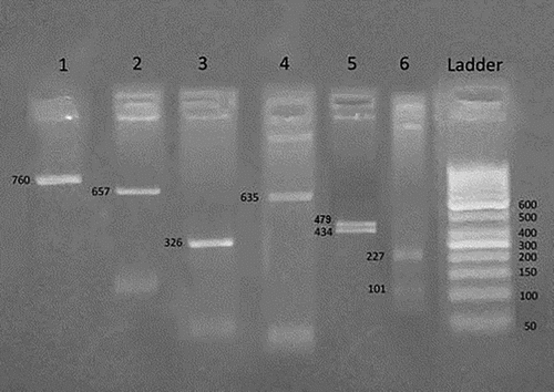 Figure 1. Homozygous Benin/Benin βS haplotype ----++/----++. An agarose gel electrophoresis of RFLP analysis by Hind II 5′ to ε gene demonstrates homozygous negative result (−/−) in number 1, XmnI 5′ to Gγ gene demonstrates homozygous negative result (−/−) in number 2, Hind III within IVS II Gγ gene demonstrates homozygous negative result (−/−) in number 3, Hind III within IVS II Aγ gene demonstrates homozygous negative result (−/−) in number 4, Hind II 3′ to ψβ gene demonstrates homozygous positive result (+/+) in number 5, Ava II within IVS II β gene demonstrates homozygous positive result (+/+) in number 6.
