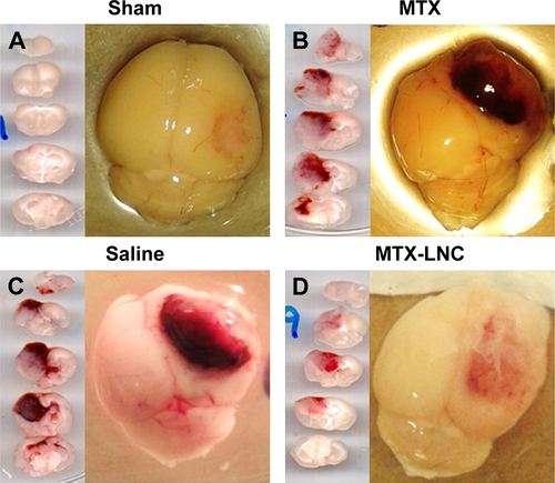 Figure S3 Representative images of mice brain segments: (A) sham-group; glioblastoma-carrying mice treated with MTX solution (B), saline (C), or MTX-LNC (D) for 10 days, in alternated days, by the oral route.Abbreviations: MTX, methotrexate; MTX-LNC, methotrexate-loaded lipid-core nanocapsules.