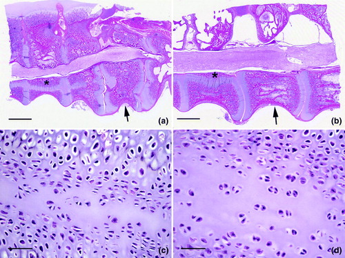 Figure 6.  Vertebral lesions. 6a: The free thoracic vertebra (arrow) is distorted and compressing the spinal cord. Longitudinal bands of cartilage (*) represent persisting longitudinal growth plates. Joint surfaces are irregular due to degeneration and necrosis. Bar = 20 mm. HE. 6b: A longitudinal band of cartilage (*) is prominent and the free thoracic vertebra (arrow) is distorted on the ventral surface. Compression of the spinal cord is mild, but some demyelination is present. Bar = 20 mm. HE. 6c: Excess cartilage matrix and disorganization of chondrocytes, features of osteochondrosis, are shown. This is a higher magnification of area * in 6b. Bar = 20 µm. HE. 6d: Higher magnification of 6c shows the disorganization of chondrocytes within an expanded matrix. Bar = 20 µm. HE.