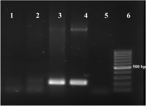 Figure 2 PCR amplification of the B1 gene.