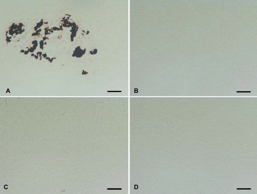 Figure 8. Von Kossa staining of (A) trypsin, (B) osmotic, (C) trypsin-osmotic, and (D) detergent-osmotic treated matrices seven days after implantation. Calcific deposits are only present in trypsin matrices (A), as indicated by black staining. Scale bar 100μm.