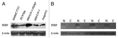 Figure 1. Screening of targeted human cancer cell line and tests of clinical samples. (A) PERP expression was assayed by immunobloting in some human cancer cell lines. SMMC7721, hepatocellular carcinoma; EC9706, esophageal carcinoma; Anip973, lung adenocarcinoma; 686/LN-1, oral squamous cell carcinoma lymph node metastasis; 686/LN-1-PERP, 686/LN-1 transfected with pcDNA3.1-PERP plasmid. (B) Four-paired samples of human lung adenocarcinoma were detected by PERP immunobloting. C, cancerous tissue of lung adenocarcinoma; N, normal lung tissue of the same patient.