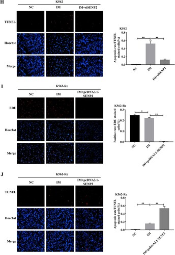 Figure 11. (A) Analysis of PI3K/AKT/mTOR signaling pathway protein expression in K562 cells and K562-Re cells treated with various concentrations of IM using Western blotting. (B) Analysis of PI3K/AKT/mTOR signaling pathway protein expression in K562-Re cells transfected with miR-629-5p inhibitor and co-transfected with miR-629-5p inhibitor and siSENP.