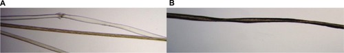 Figure 2 Microscopic hair analysis.