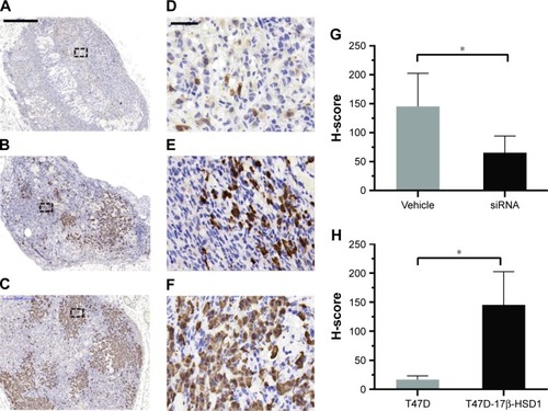 Figure 6 17β-HSD1 expression in tumors analyzed by immunohistochemistry.