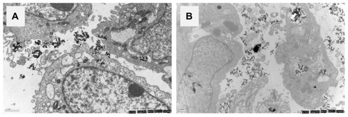 Figure 11 Transmission electron micrographs of MG-63 cells exposed to rod-like apatite and needle-like apatite for 3 days. (A) Rod apatite is close to the nuclear envelope, but does not enter into the cell nucleus. (B) Needle-like apatite leads to changes in the nucleus morphology.