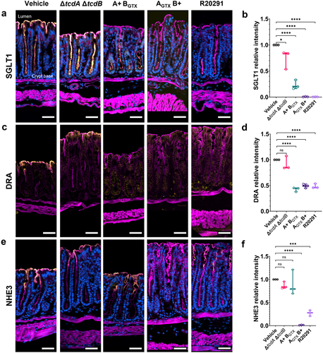 Figure 5. SGLT1 and DRA expression is decreased by TcdA or TcdB activity, but NHE3 depletion is TcdB-dependent during infection.