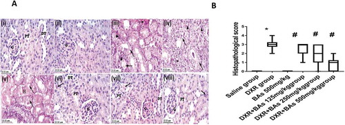 Figure 4. Effect of boswellic acids on histopathology and scores of mice treated with doxorubicin using haematoxylin and eosin staining. (a) Images for sections from the kidney represent control groups stained with H&E (x 40): (i) Normal control group and (ii) BAs control group showing sections of normal kidney. (iii, iv& v): sections from the kidney of the DXR group stained with H + E (x 40) showing KTDS. Interstitial changes (arrowhead) including focal haemorrhage and tubulointerstitial inflammatory infiltrate. Tubules (arrow) include degenerations, vacuolation, disorganized arrangement and dilatation of tubules. Pyknotic cells and necrosis (dashed arrow) and the presence of hyaline casts in cortical tubules (H). vi, vii & viii) Images for sections from the kidney of the groups treated with a combination of DXR and different doses of BAs stained with H + E (x 40): vi) DXR + BAs (125 mg/kg) group showing moderate tubular changes (KTDS II & focal III). vii) DXR + BAs (250 mg/kg) group showing mild tubular changes (KTDS I & focal II). viii) DXR + BAs (500 mg/kg) group showing normal kidney tissue with occasional mild changes in some sections (KTDS 0 & focal I). B) Boxplot graph for the median histologic score in renal sections. Ten fields of each section were randomly selected and examined under x 400 magnification, and the median of 8 animals was calculated. DXR; doxorubicin, BAs: boswellic acids, KTDS: kidney tubular damage score. Box plot was done by R-Studio Version 1.0.136 – © 2009–2016, Inc. * Compared to saline group, #Compared to DXR group, P-value < 0.05, CI = 95%, n = 8.