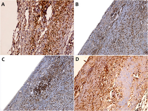 Figure 5 IHC estimation of PCNA expression in rats after four weeks of subcutaneous implantation.