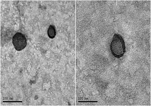 Figure 5. TEM micrographs of optimized PIP loaded BLs (F4) with 80,000 Å magnification.