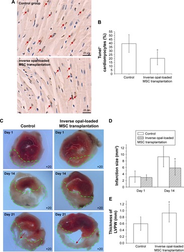 Figure 5 Inverse opal-loaded MSC transplantation contributes to decreased apoptosis and attenuated myocardial remodeling (n=12).Notes: (A, B) Image of immunofluorescent staining for TUNEL (apoptotic cardiomyocyte) in the infarct border zone 3 days after MSCs transplantation was shown and compared. (C–E) Infarct size at baseline (day 1) and at day 14 as well as the thickness of the LV posterior walls at day 21 in the two groups. The red arrows point to the LVPW at day 21 and the green dashs point to the infarct size. The data represent the mean ± SD. *P<0.05 vs the corresponding control group.Abbreviations: MSCs, mesenchymal stem cells; LVPW, left ventricular posterior wall.