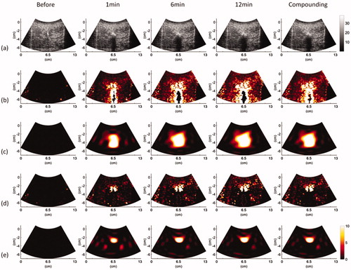 Figure 5. Typical (a) B-mode, (b) |CBE|, (c) |CBE¯|, (d) CBE|η>0, and (e) CBE¯|η>0 images obtained at various time points and under using temporal compounding (ATL = 1 cm).