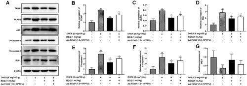 Figure 4. R. chingii treatment suppressed cell apoptosis and IR via deactivating TXNIP/NLRP3 pathway. PCOS rats were co-treated with R. chingii followed by injecting with AD-TXNIP adenovirus which was stably overexpressed TXNIP through the tail vein. TXNIP, NLRP3, ASC, P-caspase-1, C-caspase-1, and IRS-1 protein levels were examined by western blot. β-actin is a loading control. **p < 0.01 vs. control, #p < 0.05 vs. PCOS, ##p < 0.01 vs. PCOS, &p < 0.05 vs. R. chingii treatment.