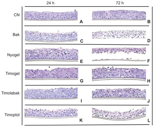 Figure 3 Histomorphological analysis of three-dimensional human corneal epithelium after 24 hours and 72 hours of treatment with saline, BAK 0.01%, and test items. Normal human corneal epithelium morphology was observed with the saline solution (A and B), ie, a layer of nonkeratinized and flattened superficial cells, and an intermediate cell layer with cells displaying lateral cytoplasmic extension similar to wing cells and a basal layer with regular column cuboidal cells. After 24 hours of treatment, BAK 0.01% modified the continuity of the superficial film morphology with the appearance of few necrotic cells and a reduced thickness compared with the control (C). The morphology after repeated application of BAK 0.01% for 72 hours was severely damaged, with tissue necrosis observed in basal cells that were still attached to the polycarbonate filter (D). Nyogel (E and F), Timogel (G and H), Timolabak (I and J), and Timoptol (K and L).