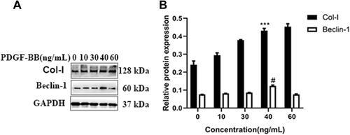 Figure 3 Western blotting was used to detect the Col-I and Beclin-1 protein expression of oral mucosal FBs stimulated by different PDGF-BB concentrations. (A) Different concentrations of PDGF-BB (0, 10, 30, 40, 60 ng/mL) were used to stimulate the FBs for 24 h. (B) The effect of the different PDGF-BB concentrations on the Col-I and Beclin-1 protein expression in the FBs. When the Col-I in the 40-ng/mL group is compared with that in the 0-, 10-, 30-ng/mL groups, ***P < 0.001; when the Beclin-1 in the 40-ng/mL group is compared with that in the 0-, 10-, 30-, and 60-ng/mL groups, #P < 0.05.