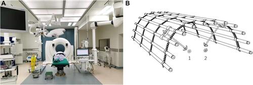 Figure 1 Localization of multiple pulmonary nodules in hybrid operating room. (A) Hybrid operating room and large-aperture sliding rail CT; (B) schematic diagram of simultaneous localization and puncture of pulmonary nodules 1 and 2 with full-coverage thoracic surface locating grid.