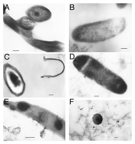Figure 5. TEM of BCG-BG cell ultrathin sections (longitudinal and transversal) from: Control culture of dividing cells with cell walls and cytoplasm substructures of ribosomes and nucleoid (A) and (B); Stress starved culture- cells with separated cell walls (C), wall less bacterial cells (D), elongated L-forms with elementary bodies located inside (E) and single spherical L-bodies (F). Bar = 0.2µm