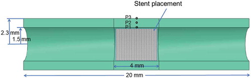 Figure 4. Geometry of the coronary artery model, the stent is placed in the middle of the model.