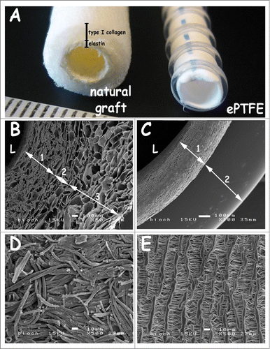 Figure 1. Macroscopic view and scanning electron micrographs of the triple-layered natural graft and the control graft Propaten (ePTFE). (A) macroscopic view. (B-C) cross-sections, (D-E) luminal surface morphology. The natural graft displays a 3 layered architecture with an inner elastin layer (B-1), an intermediate porous/lamellar type I collagen film for strength (B-2) and a porous outer type I collagen layer (B-3). In the PTFE graft the wall (C-1) and the supporting ring (C-2) are seen. Scanning electron microscopy reveals differences in wall thicknesses and porosity between both grafts. Luminal lining of the natural graft consists of elastin fibers (D), whereas the ePTFE graft displays lamellae with perpendicular struts (E). Bars represent 100 µm (B-C) and 10 µm (D-E). L: lumen.