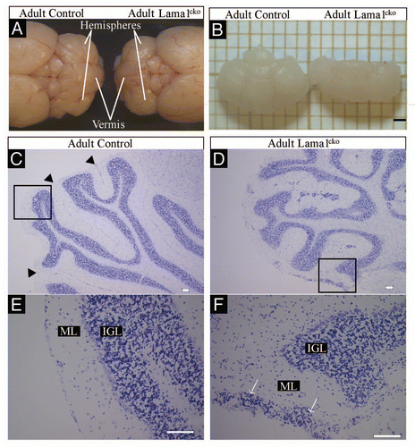 Figure 1 Abnormal cerebellar organization in adult Lama1cko animals. Macroscopic observation of whole cerebella (A and B) reveals a reduced size of Lama1cko adult cerebellum compare with control. Histological examination of coronal sections of adult control (C) and Lama1cko (D) cerebella stained with cresyl violet demonstrates abnormal foliation and global perturbation of cerebellar layers (E and F). Black arrow heads are pointing out the limits between folia in control mice (C). White arrows are pointing out islets of ectopic cells abnormally located in the outer part of the molecular layer of Lama1cko (F). Scale bars: 1 mm (A), 100 µm (C–F). ML, Molecular Layer; IGL, Internal Granular Layer.
