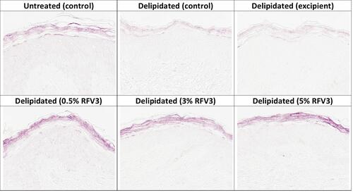 Figure 5 Immunostaining of ceramides in the stratum corneum with day 1 explants. Starting top left samples: Untreated control, delipidated control, delipidated excipient treated, delipidated 0.5% RFV3 treated, delipidated 0.3% RFV3 treated, delipidated 5% RFV3 treated.